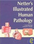 Netter´s Illustrated Human Pathology Netter´s Illustrated Human Pathology