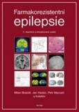 Farmakorezistentni epilepsie - 2. doplněné a aktualizované vydání