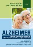 Alzheimer Alzheimer